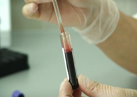 Criança vai receber R$ 15 mil após diagnóstico errado de câncer em Manaus