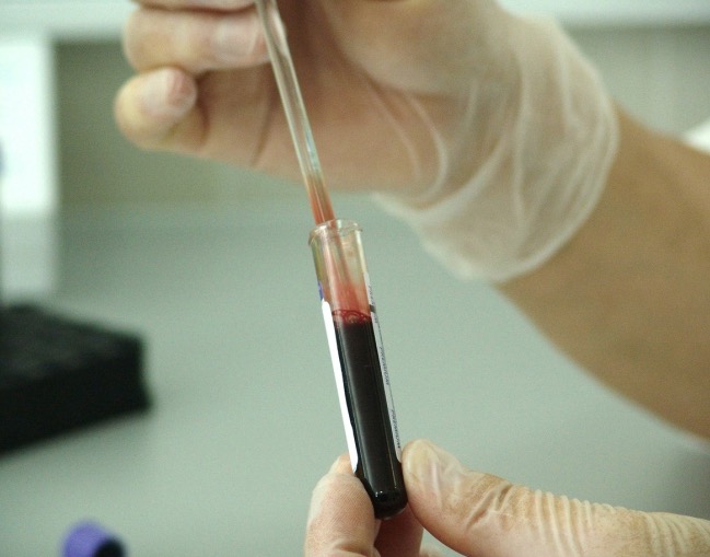 Criança vai receber R$ 15 mil após diagnóstico errado de câncer em Manaus