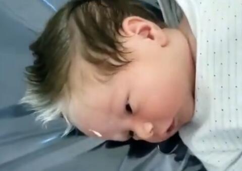 Bebê nasce com condição rara no cabelo e vira sucesso na web