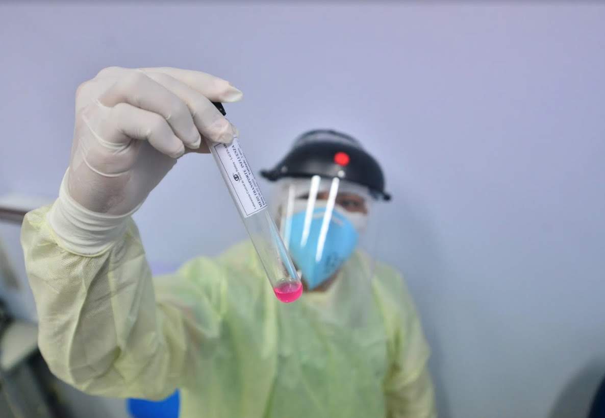 Saúde atualiza dados da pandemia; 3,5 milhões de casos registrados