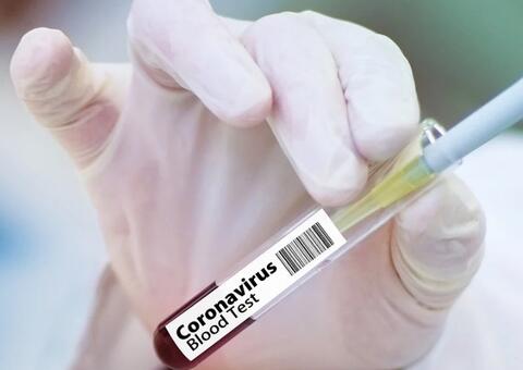 Controle da pandemia no Brasil poderia ser vitória para o mundo, diz OMS