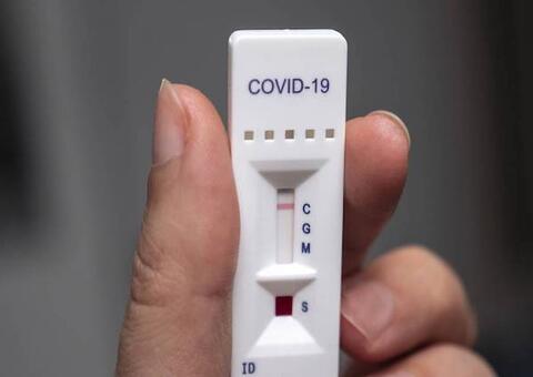 Mais de 160 profissionais de educação com Covid-19 no Amazonas