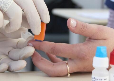 Veja as regras para fazer exame de Covid-19 pelo plano de saúde