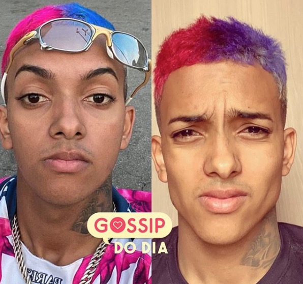 Aos 19, MC Brinquedo faz harmonização facial e resultado surpreende