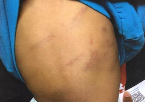 Padrasto é preso por agredir bebê de noves meses com chicote 