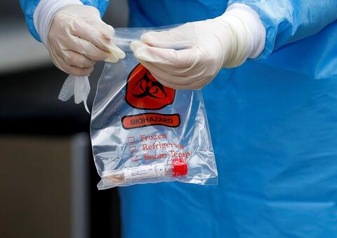 Médicos investigam 7 pacientes que podem ter se reinfectado por coronavírus