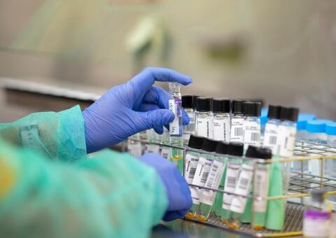 Brasil tem mais de 20 possíveis reinfecções por Covid-19 em investigação