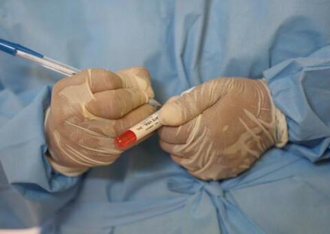 FVS confirma escola com mais de 20 professores com Covid-19 em Manaus