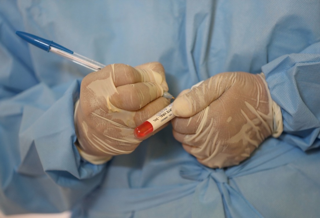 FVS confirma escola com mais de 20 professores com Covid-19 em Manaus