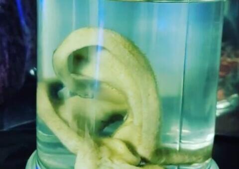 Homem tira as orelhas para 'melhorar a estética' e guarda em pote