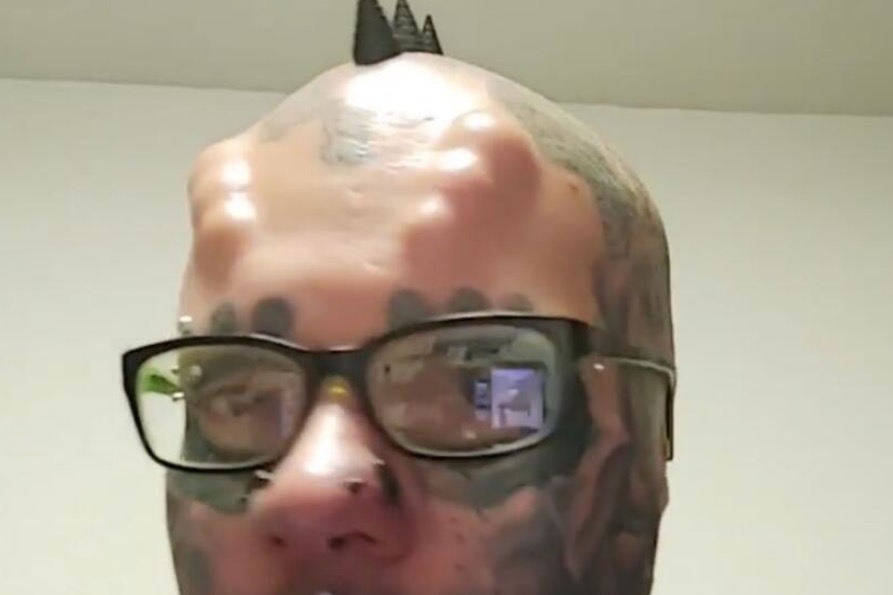 Homem tira as orelhas para 'melhorar a estética' e guarda em pote