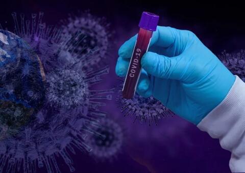 Homens têm maior risco de agravamento no quadro da Covid-19, diz estudo