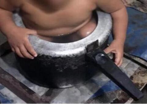 Criança de dois anos é resgatada após ficar presa em panela de pressão