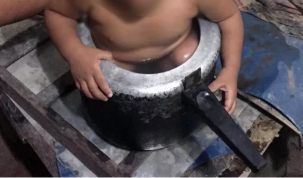 Criança de dois anos é resgatada após ficar presa em panela de pressão