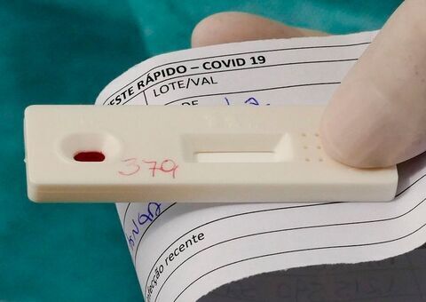 Perto de 120 mil mortes, Brasil tem 855 óbitos em 24 horas