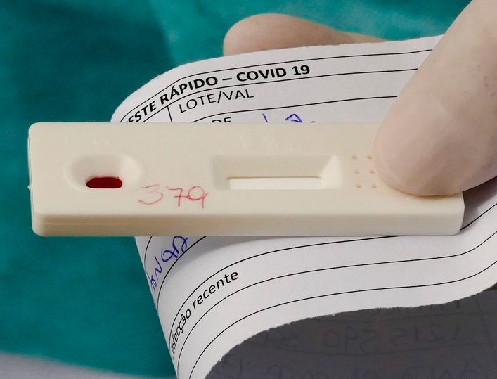 Perto de 120 mil mortes, Brasil tem 855 óbitos em 24 horas