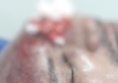 Funcionário público tem rosto desfigurado durante briga em hotel de Manaus