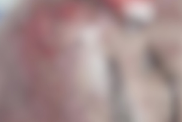 Funcionário público tem rosto desfigurado durante briga em hotel de Manaus