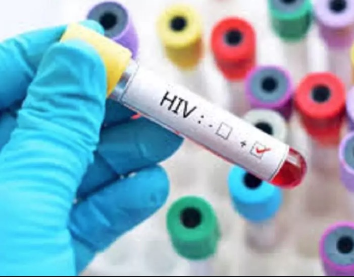 Mulher pode ter sido curada de HIV sem tratamento médico, aponta pesquisa