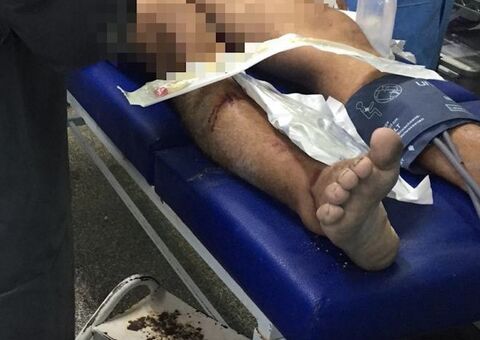 Jovem é perseguido e esfaqueado em rua de Manaus