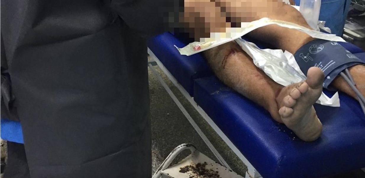 Jovem é perseguido e esfaqueado em rua de Manaus