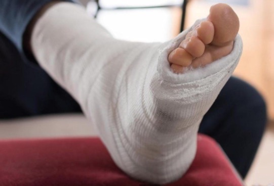 Ex-presidiário leva tiros nos pés em plena luz do dia em Manaus 