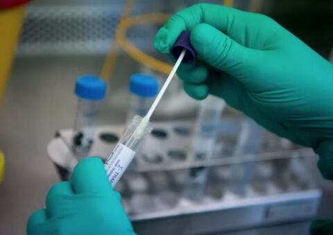 Investigação de mortes por SRAG inclui mais 146 casos de covid-19 em Manaus