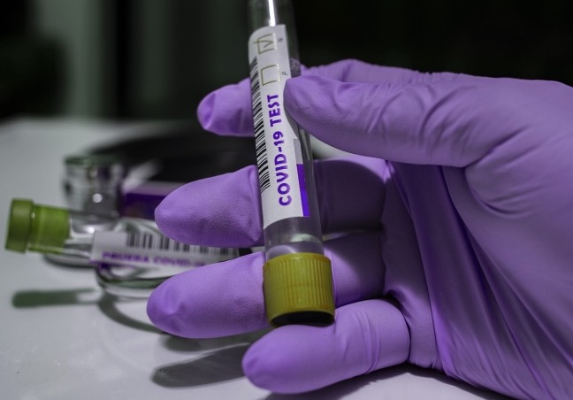 Amazonas chega a 122.520 casos e 3.828 mortes pela Covid-19