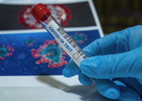 Covid pode demorar até 36 dias para desaparecer do corpo, diz estudo