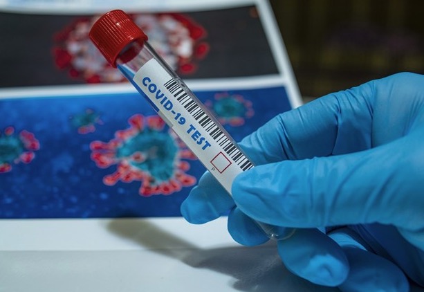 Covid pode demorar até 36 dias para desaparecer do corpo, diz estudo