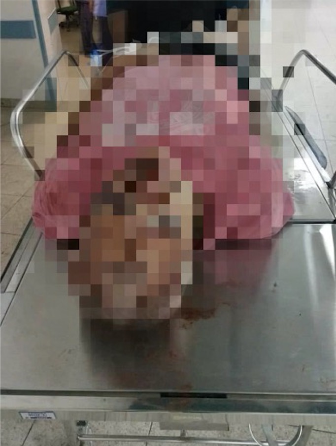 Idoso é espancado após ser flagrado estuprando vizinha de 6 anos