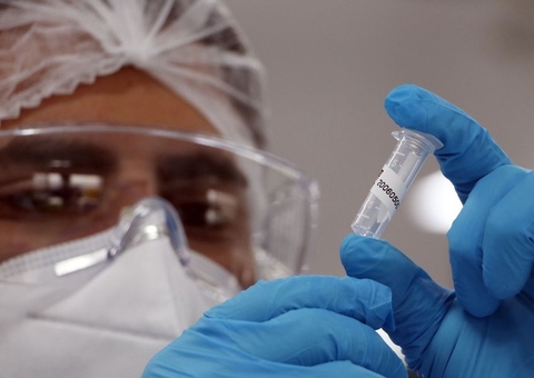 Brasil registra 682 novos óbitos pela Covid em 24 horas