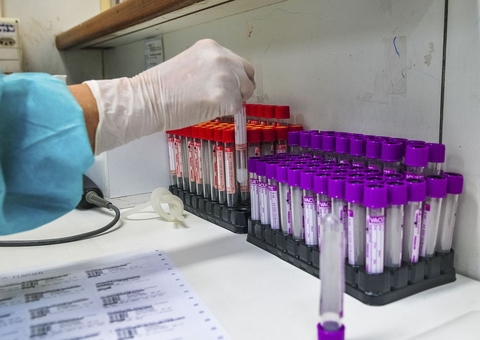 Covid-19: Pesquisadores desenvolvem teste sorológico 20 vezes mais barato