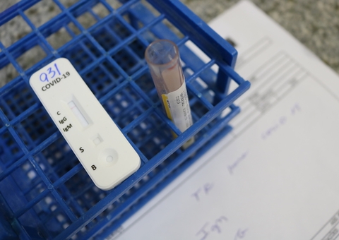 Na FCecon, pacientes oncológicos são testados para covid-19