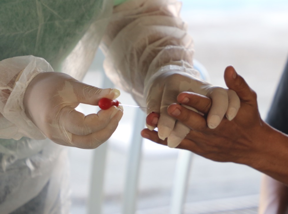 Seduc abre mais de mil vagas para teste de Covid-19 em Manaus