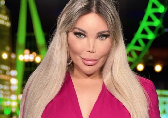 Barbie humana fica com 'buraco enorme' no rosto após procedimento