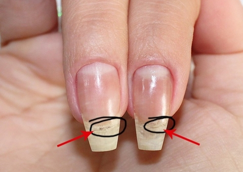 Conheça o melhor fortalecedor de unhas que você pode fazer em casa