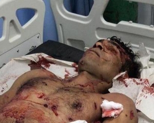 Há outros Lázaros, dos quais suspeitamos e que matam em série