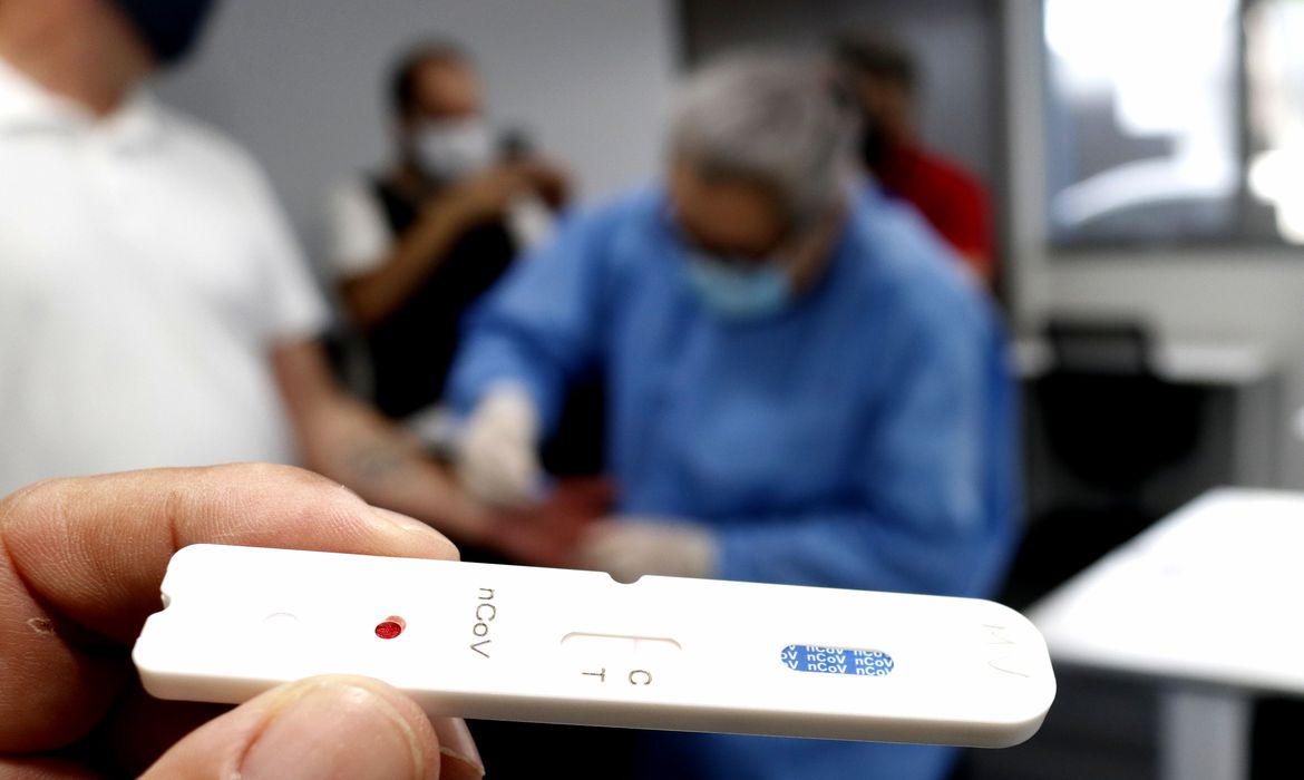 Amazonas registra 175 novos casos de Covid em 24 horas