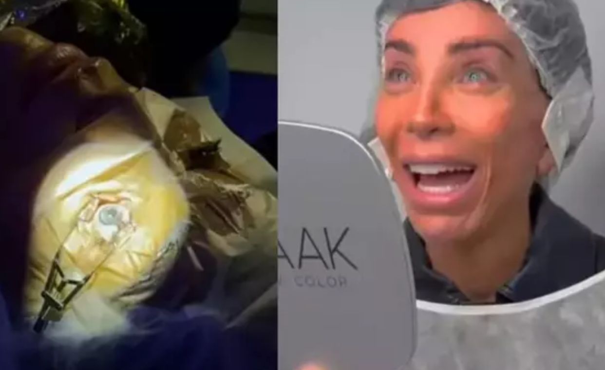 Maya Massafera faz cirurgia para mudar a cor dos olhos