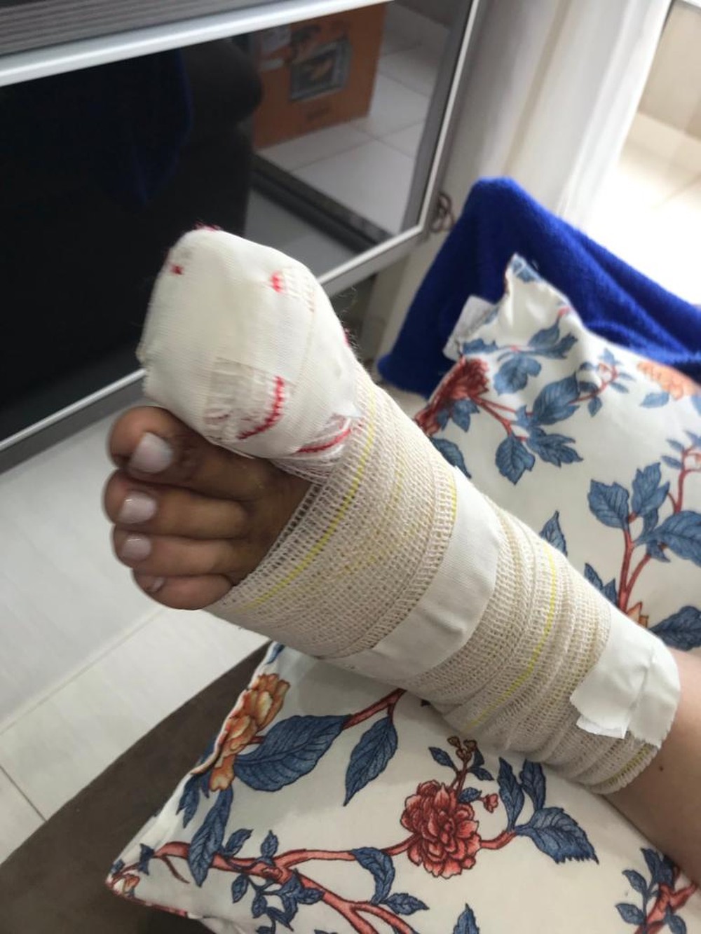 Durante compras, empilhadeira esmaga pé de cliente e dedão é amputado