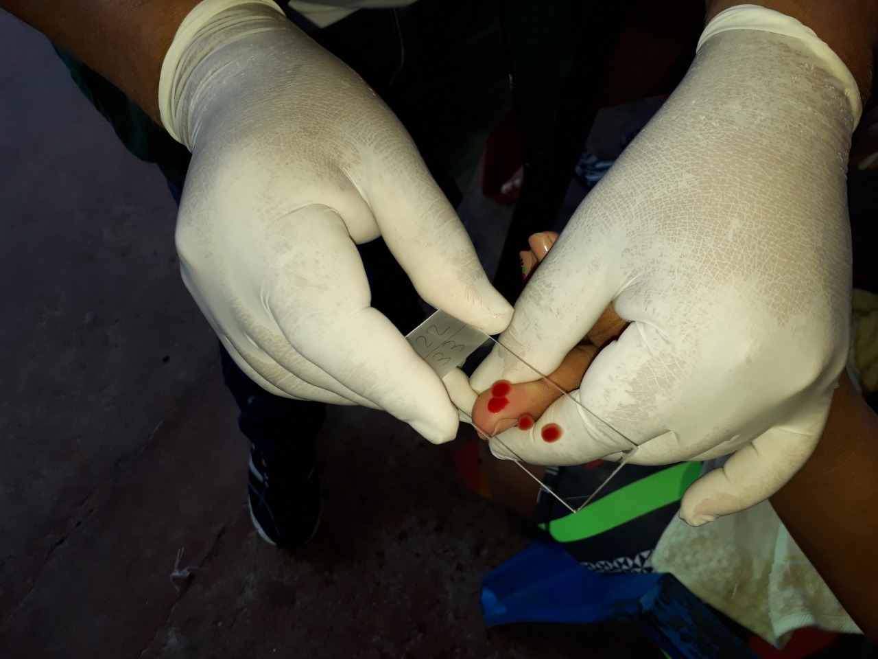 Em um ano, casos de malária reduzem 37% em Manaus