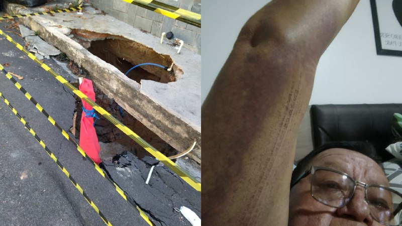 Obras na cratera que deixou idoso ferido em Manaus começam nesta sexta 