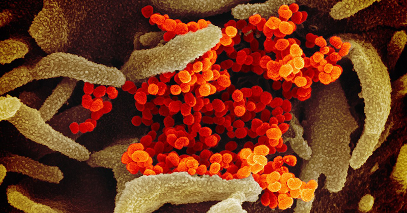 Variante encontrada em Manaus é três vezes mais contagiosa, diz Pazuello