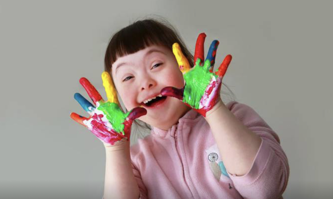 Deputados apresentam projetos que beneficiam pessoas com Síndrome de Down