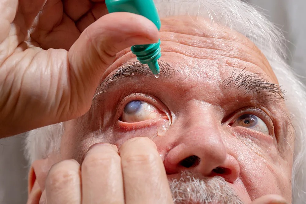 Dia Nacional de Combate ao Glaucoma alerta para prevenção da doença