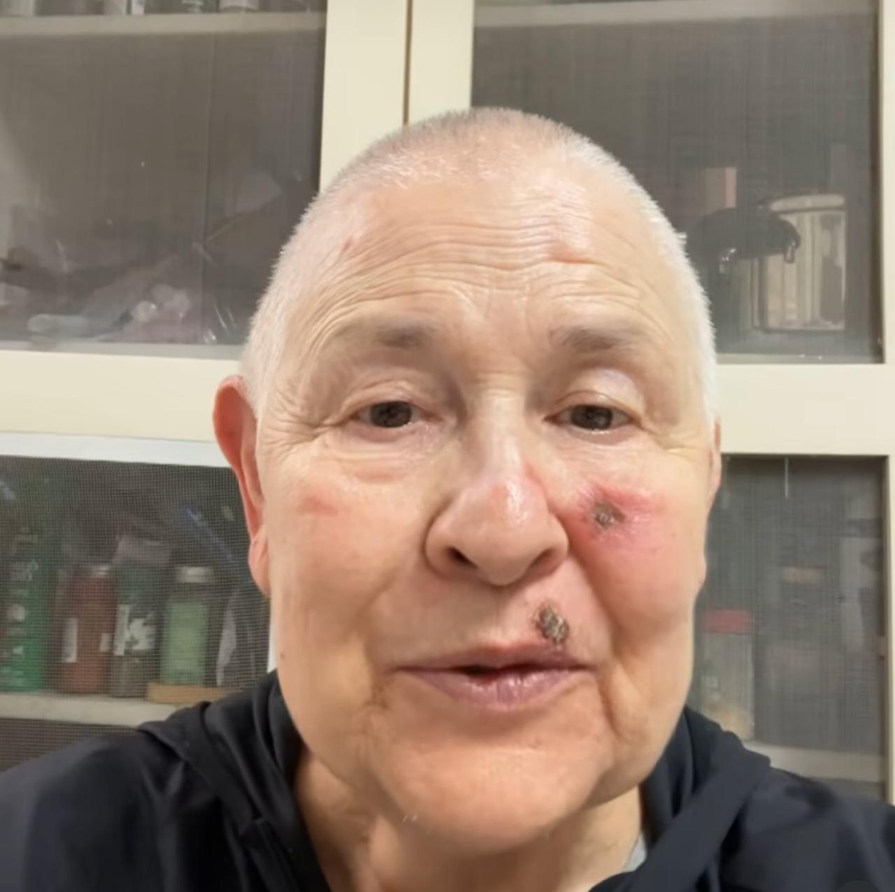 Monja Coen anuncia tratamento contra câncer