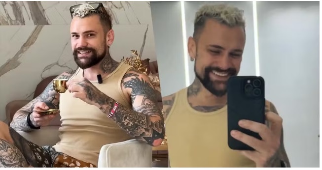 Ex-BBB Vinicius Rodrigues faz harmonização facial; confira resultado