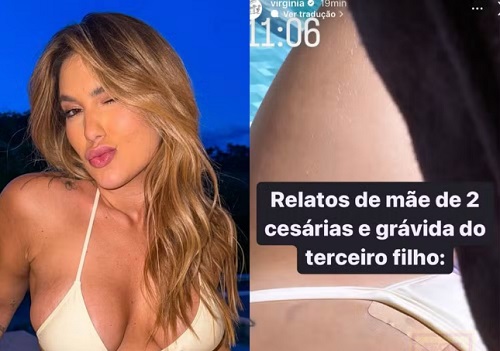 Grávida do 3º filho, Virginia mostra ponto inflamado após 1 ano de cesárea