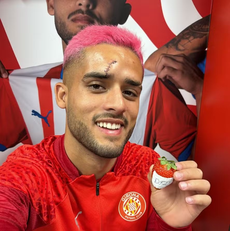 Yan Couto, do Girona, mostra pontos no rosto após choque com companheiro